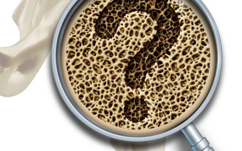 Osteoporose – uma rotina preventiva