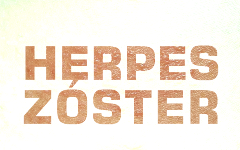 Herpes Zóster